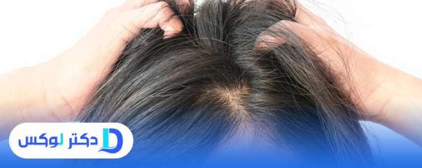 علل ضعیف شدن فولیکول های مو